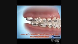 بهترین متخصص ارتودنسی