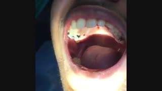 نحوه چسباندن بند