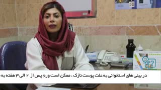 سوالات متداول بعد از جراحی بینی