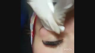 کلینیک زیبایی iranbeauty.net جراحی لثه