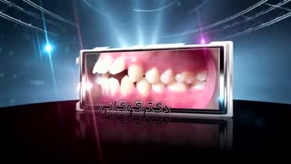 معجزه ارتودنسی با سیستم دیمون