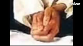صحنه های تکاندهنده از بیماری پوستی مایکل جکسون