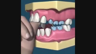 تاثیر مکیدن انگشت بر دندانها، دکتر سهراب آصفی