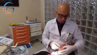 قراردادن سیم ارتودنسی | دکتر مسعود داوودیان دندان پیش