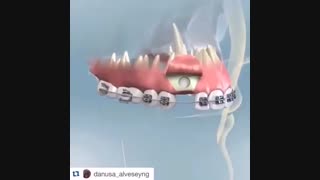 ارتودنسی دندان نیش نهفته، دکتر سهراب آصفی