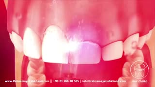 افزایش طول تاج دندان