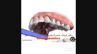 مراحل ارتودنسی