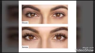مژه رشد میکند؟