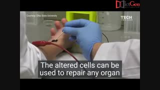 بهبود آسیب های مغذی در عرض چند ثانیه