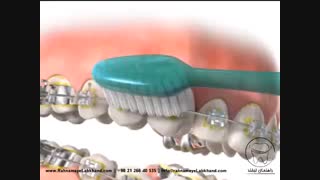 بهداشت ارتودنسی