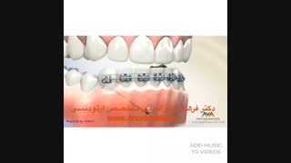 ارتودنسی قبل و بعد