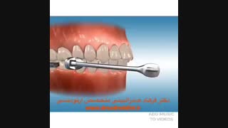 مراحل ارتودنسی