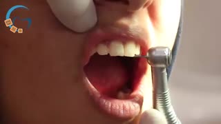 تنظم لبه دندانها در پایان ارتودنسی | دکتر مسعود داوودیان