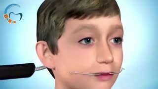 دستگاه هدگیر ارتودنسی | دکتر مسعود داوودیان