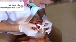 براکت گذاری در یکی از بیماران-دکتر سعید قریشی