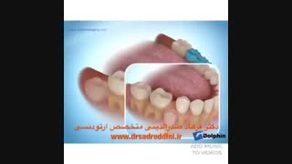 بهترین متخصص ارتودنسی