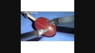 رباتی بسیار کاربردی با دقت فوقالعاده بالا برای جراحی و کارهای ظریف. پوست انگور رو با چه دقتی جدا کرد