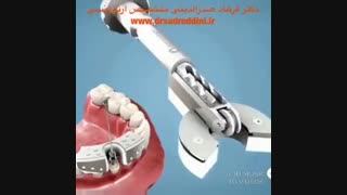 مراحل ارتودنسی