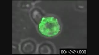 نخستین ویدیو از نحوه ی پخش ویروس ایدز در سلول های بدن !!!