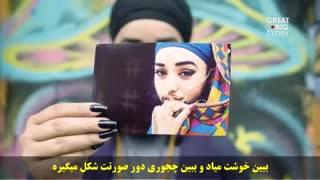 دختری زیبا با ریش و سبیل مردانه