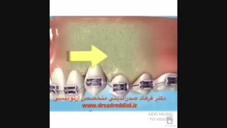 بهترین متخصص ارتودنسی