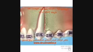 متخصص ارتودنسی پاکسازی پوست