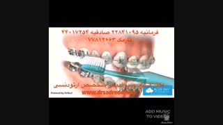 متخصص ارتودنسی درمان ریزش مو