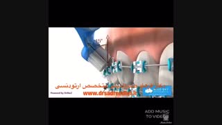 متخصص ارتودنسی در غرب تهران