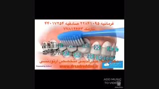 متخصص ارتودنسی برداشتن خال