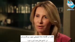 انواع روش های درمان شوره سر