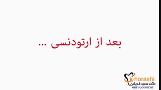 ارتودنسی کودکان-دکتر سعید قریشی جراحی لثه