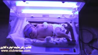 اجاره دستگاه درمان زردی نوزاددر منزل