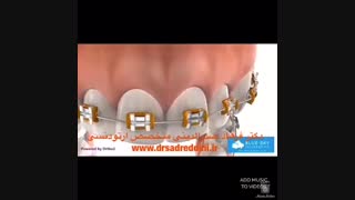 مراحل ارتودنسی