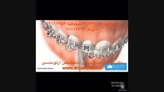 متخصص ارتودنسی لیزر موهای زائد