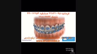 متخصص ارتودنسی برداشتن توده