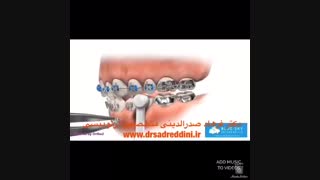 ارتودنسی قبل و بعد