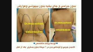 لیپوماتیک کمر و پهلو