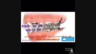 بهترین متخصص ارتودنسی