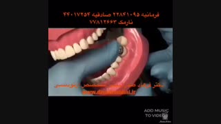 متخصص ارتودنسی پیلینگ شیمیایی