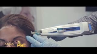 مزوتراپی چیست و چگونه انجام می شود؟