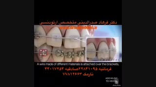 متخصص ارتودنسی